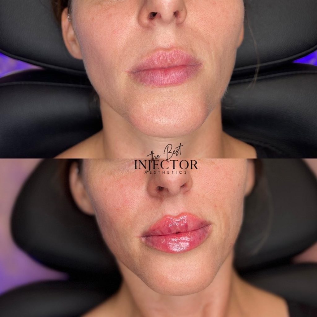 Best Injector – West Atlantic Ave Studio 33 Delray Beach, FL at The Best Injector