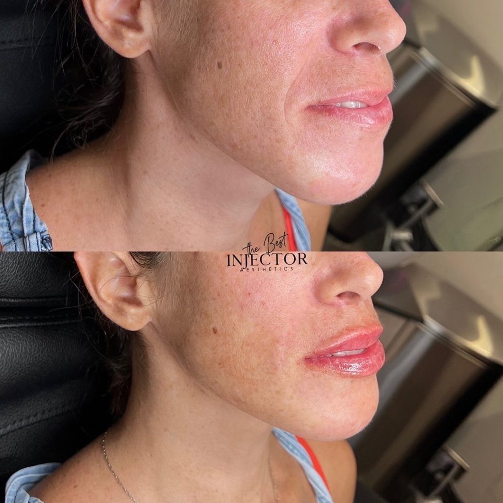 Best Injector – West Atlantic Ave Studio 33 Delray Beach, FL at The Best Injector
