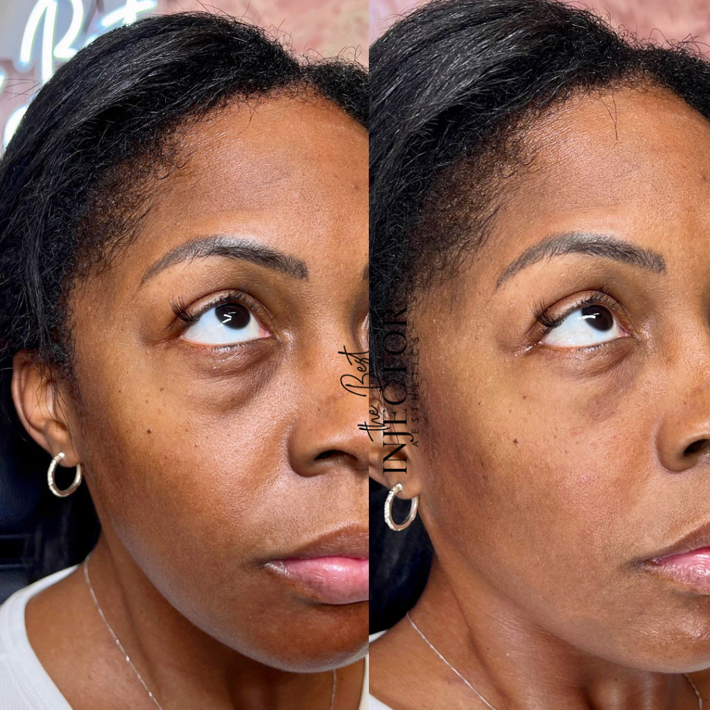 Best Injector – West Atlantic Ave Studio 33 Delray Beach, FL at The Best Injector