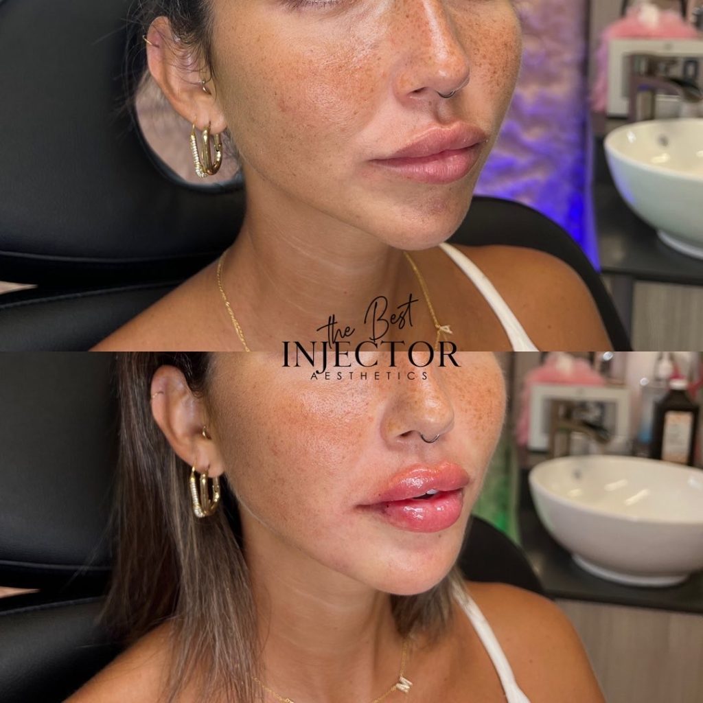 Best Injector – West Atlantic Ave Studio 33 Delray Beach, FL at The Best Injector
