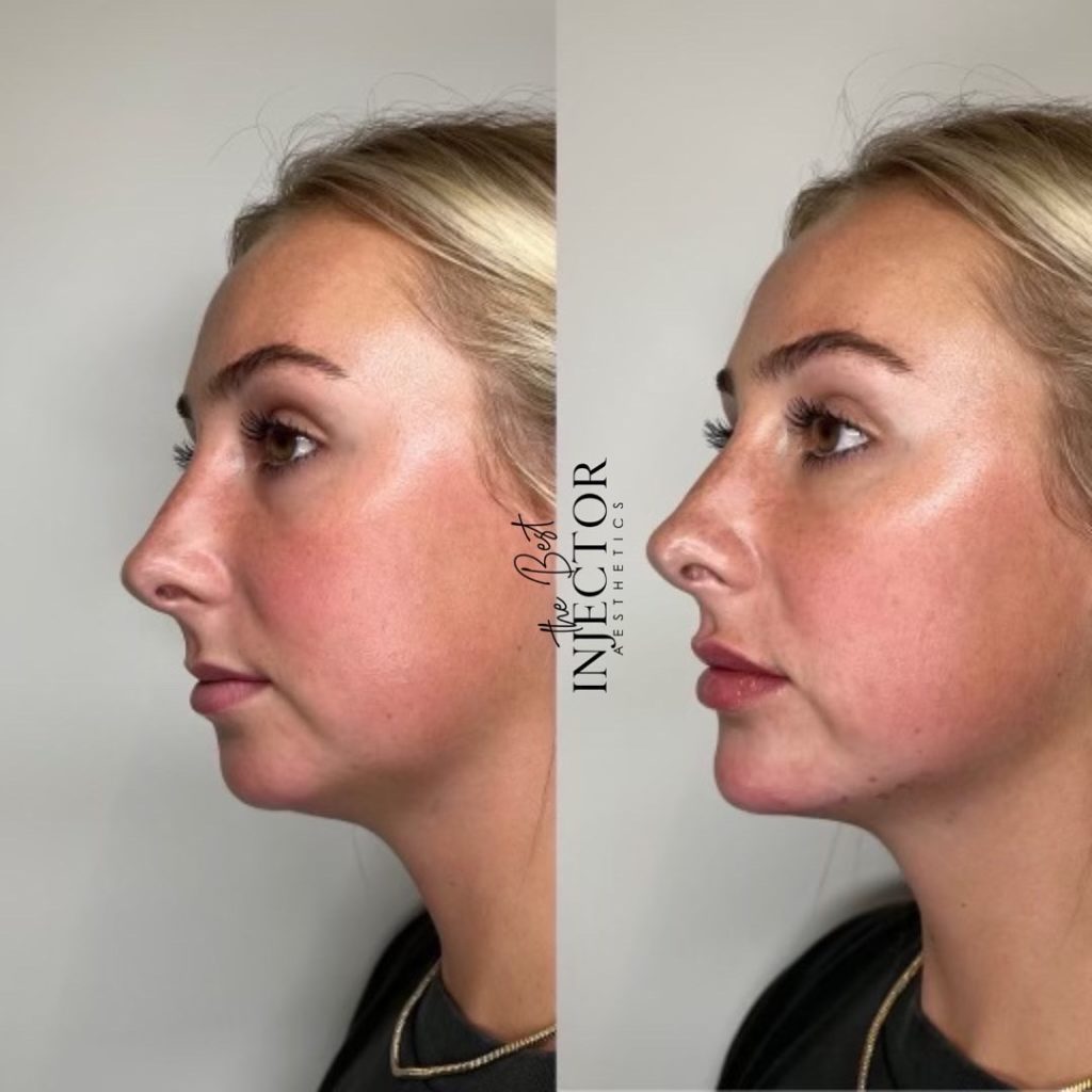 Best Injector – West Atlantic Ave Studio 33 Delray Beach, FL at The Best Injector