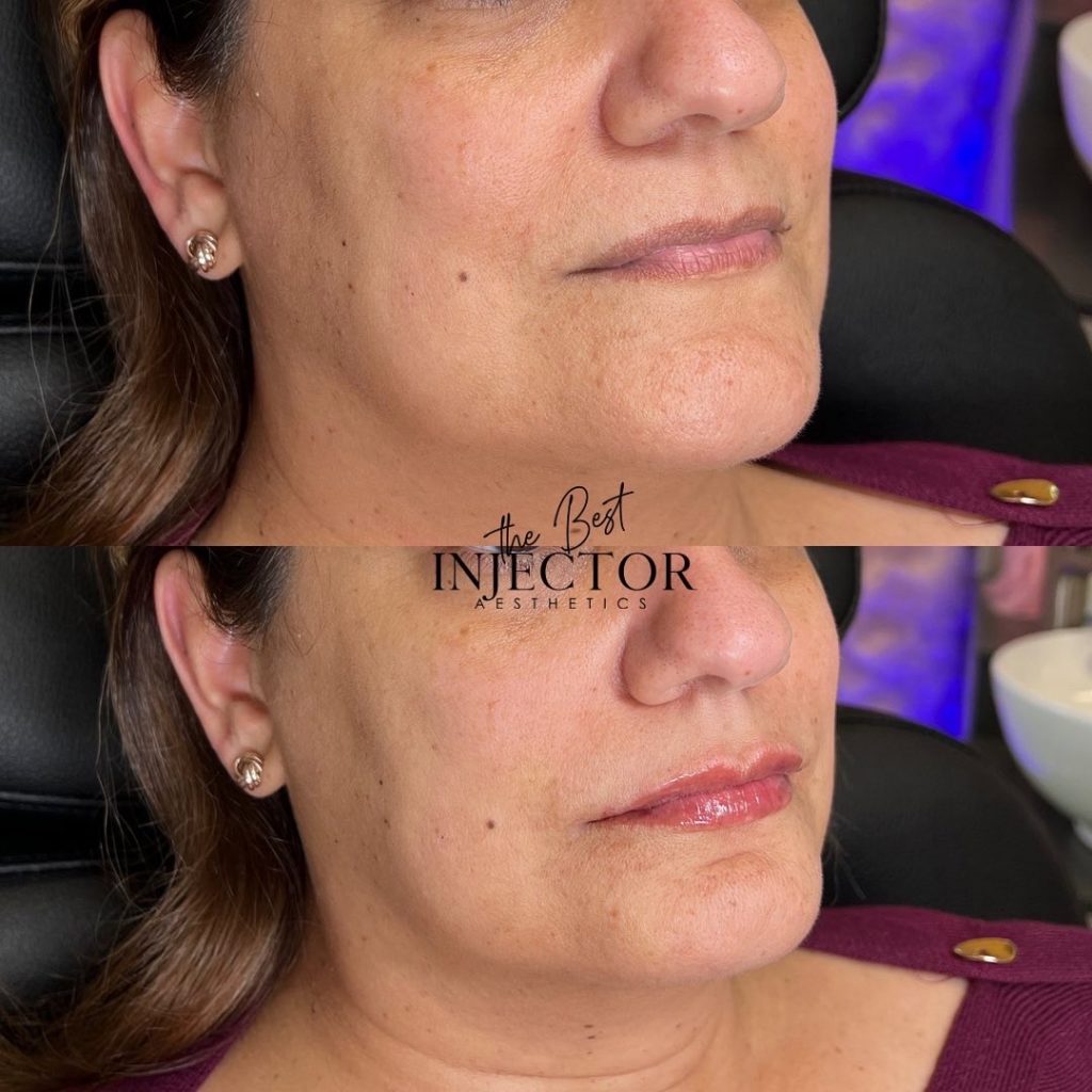 Best Injector – West Atlantic Ave Studio 33 Delray Beach, FL at The Best Injector
