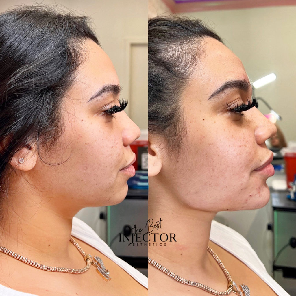 Best Injector – West Atlantic Ave Studio 33 Delray Beach, FL at The Best Injector