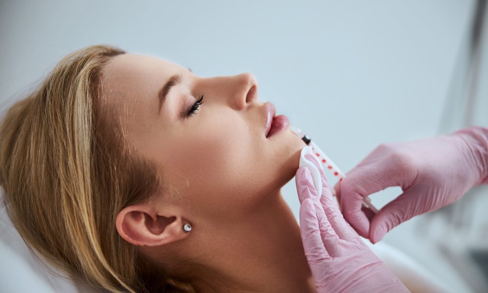 Dermal-Fillers-by-The-Best-Injector-in-Delrey-beach-FL at The Best Injector