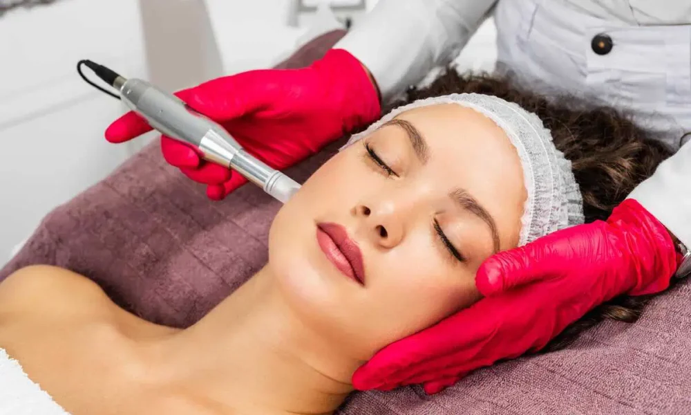 Microneedling best injector at The Best Injector